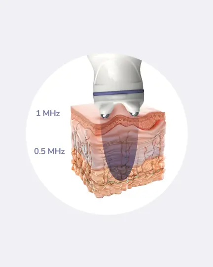 Bipolar RF